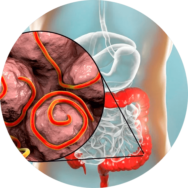 Virškinimo traktas ir parazitai