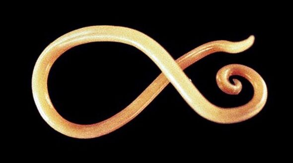 nematodo kirminas iš žmogaus kūno