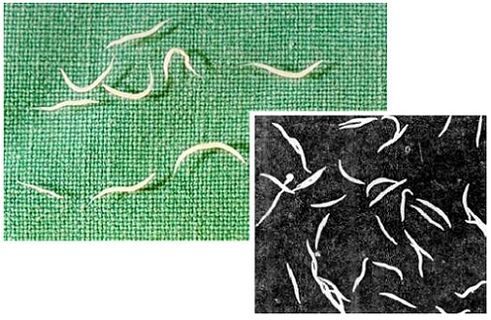 pinworms iš žmogaus kūno